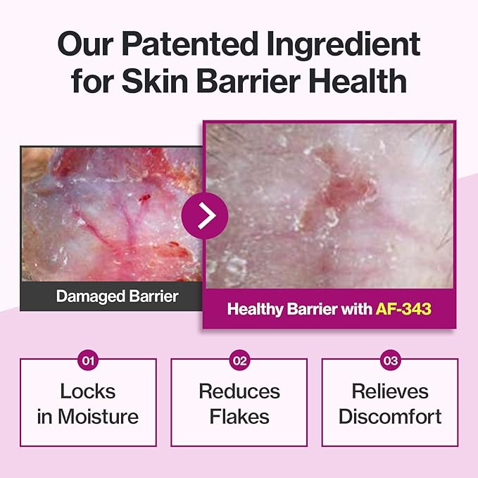 Doctor By Cat Silk Derma Lickable Feline Skin and Coat Supplement - Dandruff Treatment & Itchy Skin Relief Allergy Support for a Glossy Coat Immune Boosting Formula - 30 Individual Treat Tubes